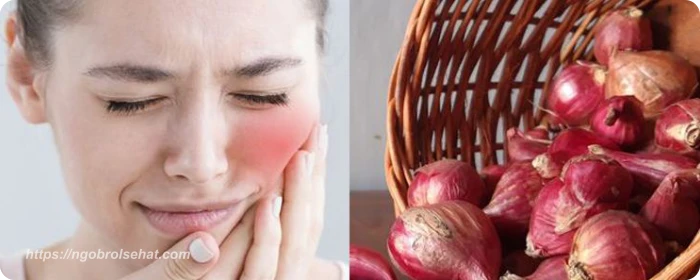 bawang merah untuk gigi cara tradisional yang terbukti ampuh - ngobrol sehat