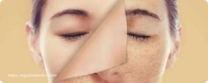manfaat biotin untuk wajah mencegah kulit kusam - ngobrol sehat